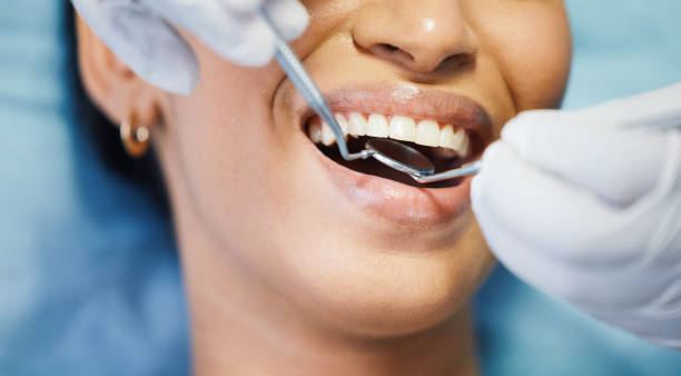 Best Broken or Chipped Tooth Repair in Manana, HI